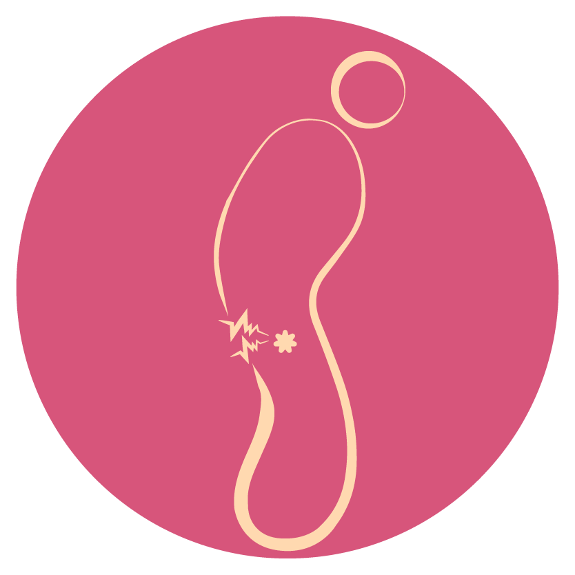 Hemorrhoids