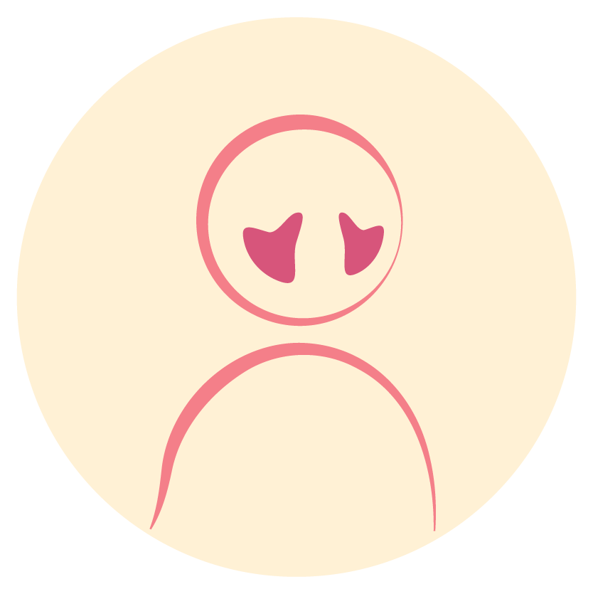 Melasma